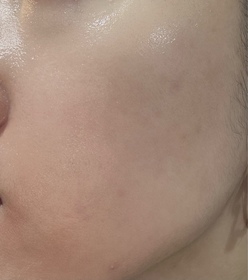 zetalhc-SHISEIDO 資生堂ULTIMUNE皇牌免疫力活膚精華_2