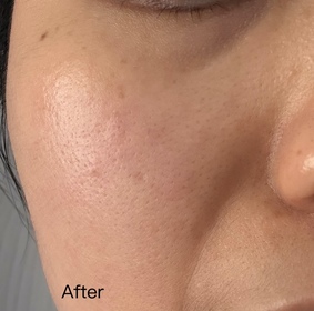 Candy Ng-BIODERMA 貝膚黛瑪水活保濕精華肌底液_1