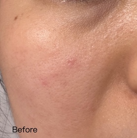 Candy Ng-BIODERMA 貝膚黛瑪水活保濕精華肌底液_3