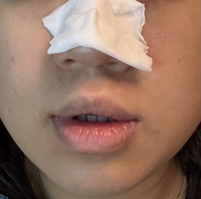 Celia Mok-BIODERMA 貝膚黛瑪水活保濕精華肌底液_1