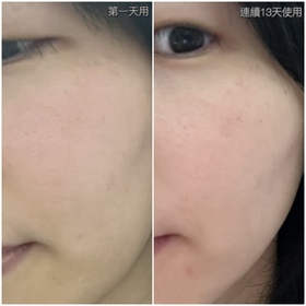 green-SHISEIDO 資生堂ULTIMUNE皇牌免疫力活膚精華_3