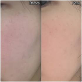green-SHISEIDO 資生堂ULTIMUNE皇牌免疫力活膚精華_4