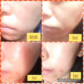 Tszki-LA ROCHE-POSAYCICAPLAST B5 PRO 極效修復面膜_1