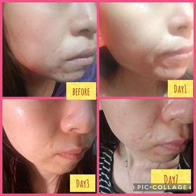 Tszki-LA ROCHE-POSAYCICAPLAST B5 PRO 極效修復面膜_2