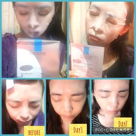 Tszki-LA ROCHE-POSAYCICAPLAST B5 PRO 極效修復面膜_3