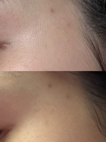 PYLau-SHISEIDO 資生堂ULTIMUNE皇牌免疫力活膚精華_3