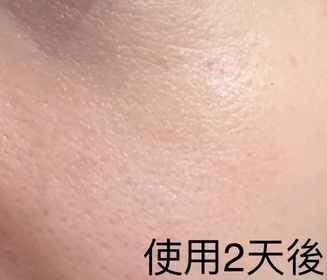 Karen-SHISEIDO 資生堂ULTIMUNE皇牌免疫力活膚精華_1