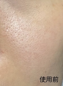 Karen-SHISEIDO 資生堂ULTIMUNE皇牌免疫力活膚精華_2