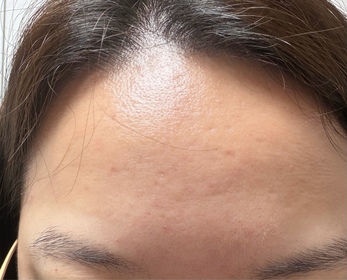Jojo-LA ROCHE-POSAYCICAPLAST B5 PRO 極效修復面膜_2