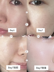mtbcbee-SHISEIDO 資生堂ULTIMUNE皇牌免疫力活膚精華_2