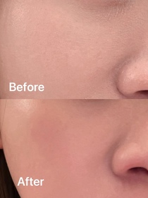 Nikkichana-BIODERMA 貝膚黛瑪水活保濕精華肌底液_2