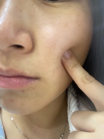 kaka-SHISEIDO 資生堂ULTIMUNE皇牌免疫力活膚精華_2