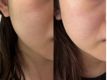 Yan-SHISEIDO 資生堂ULTIMUNE皇牌免疫力活膚精華_4