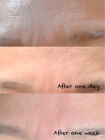 Cheung ling-BIODERMA 貝膚黛瑪B3保濕修復彈潤精華 (法國透光水)_1