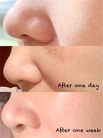 Cheung ling-BIODERMA 貝膚黛瑪B3保濕修復彈潤精華 (法國透光水)_2