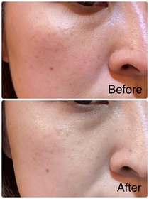 Meric-LA ROCHE-POSAYCICAPLAST B5 PRO 極效修復面膜_1