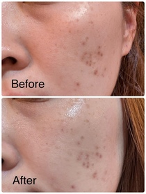 Meric-LA ROCHE-POSAYCICAPLAST B5 PRO 極效修復面膜_2