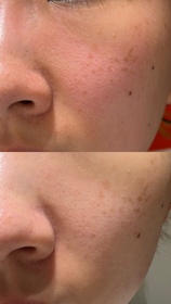 rleungyt-LA ROCHE-POSAYCICAPLAST B5 PRO 極效修復面膜_2