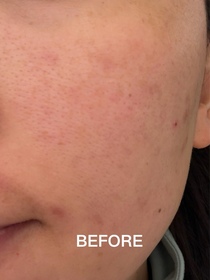 Hello_Fu-LA ROCHE-POSAYCICAPLAST B5 PRO 極效修復面膜_3