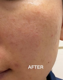 Hello_Fu-LA ROCHE-POSAYCICAPLAST B5 PRO 極效修復面膜_4