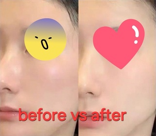 Fng-FIRST AID BEAUTY強效保濕修復燕麥⾯霜_2