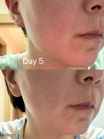 Phoebe-LA ROCHE-POSAYCICAPLAST B5 PRO 極效修復面膜_2