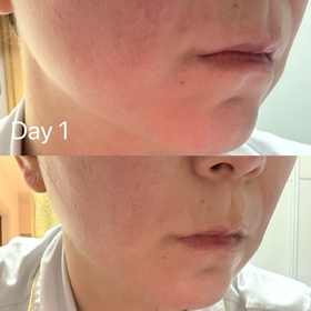 Phoebe-LA ROCHE-POSAYCICAPLAST B5 PRO 極效修復面膜_3