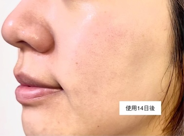 alice-SHISEIDO 資生堂ULTIMUNE皇牌免疫力活膚精華_1