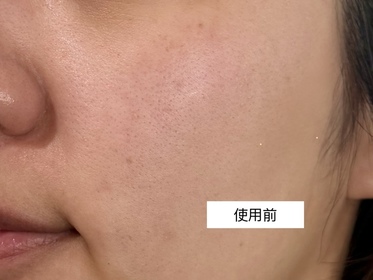 alice-SHISEIDO 資生堂ULTIMUNE皇牌免疫力活膚精華_2