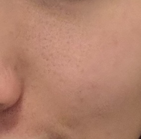 Suki-LA ROCHE-POSAYCICAPLAST B5 PRO 極效修復面膜_1