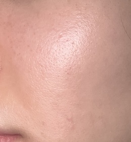 Suki-LA ROCHE-POSAYCICAPLAST B5 PRO 極效修復面膜_2