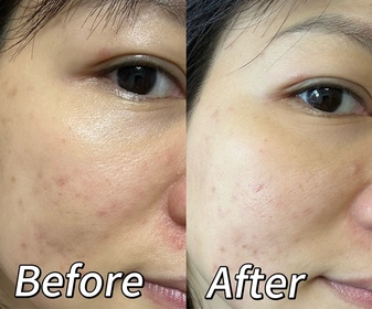 Cherrie-BIODERMA 貝膚黛瑪B3保濕修復彈潤精華 (法國透光水)_2