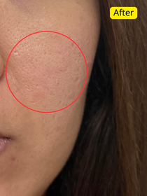 mandyf128-BIODERMA 貝膚黛瑪水活保濕精華肌底液_3