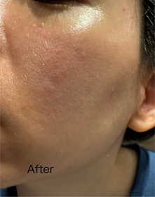 TT-BIODERMA 貝膚黛瑪B3保濕修復彈潤精華 (法國透光水)_2