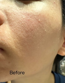 TT-BIODERMA 貝膚黛瑪B3保濕修復彈潤精華 (法國透光水)_4
