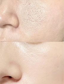 YYeman-L'ORÉAL PARiS超水光精華_4
