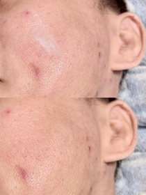 Vince-Bioré水感智能防曬慕斯_3