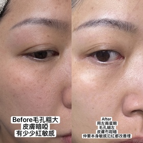 Jovian-Spa treatmentB5冰萃水光瓶_2
