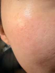AnnieNg-L'ORÉAL PARiS超水光精華_1