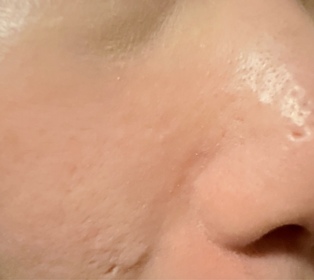 AnnieNg-L'ORÉAL PARiS超水光精華_4