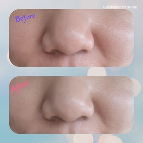 pik234-NIVEAQ10全方位抗糖抗皺雙抗精華 _2
