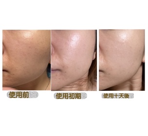 chasiutung-L'ORÉAL PARiS超水光精華_3