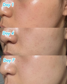 samanthang1117-L'ORÉAL PARiS超水光精華_1