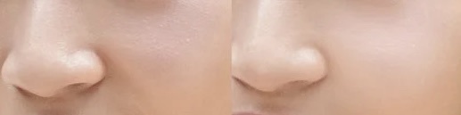 Caaarolsze-NIVEAQ10全方位抗糖抗皺抗曬日乳_1