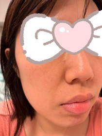 jodidii-NIVEAQ10全方位抗糖抗皺抗曬日乳_3