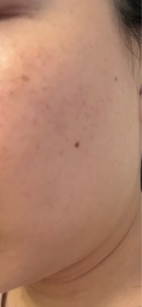 GinGin-NIVEALUMINOUS630雙效淡斑透白精華_2