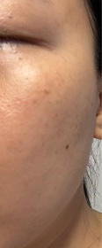 GinGin-NIVEALUMINOUS630雙效淡斑透白精華_3