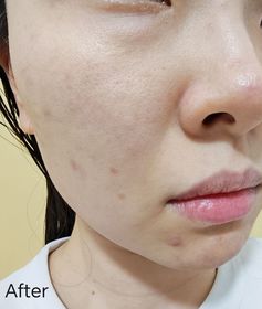 karun-ELIXIR幹細胞膠原年輕緊緻精華_2