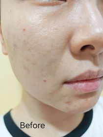 karun-ELIXIR幹細胞膠原年輕緊緻精華_3