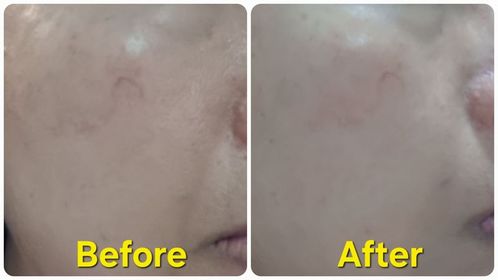 Verna-ELIXIR高純維 A 重點膠原抗皺霜_4